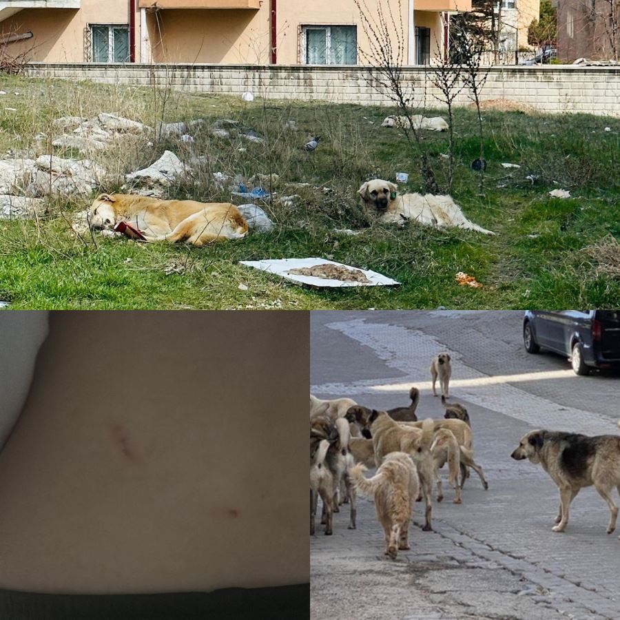 Sokak köpekleri 10 yaşındaki çocuğu ısırdı 